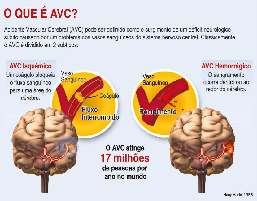Avc exames
