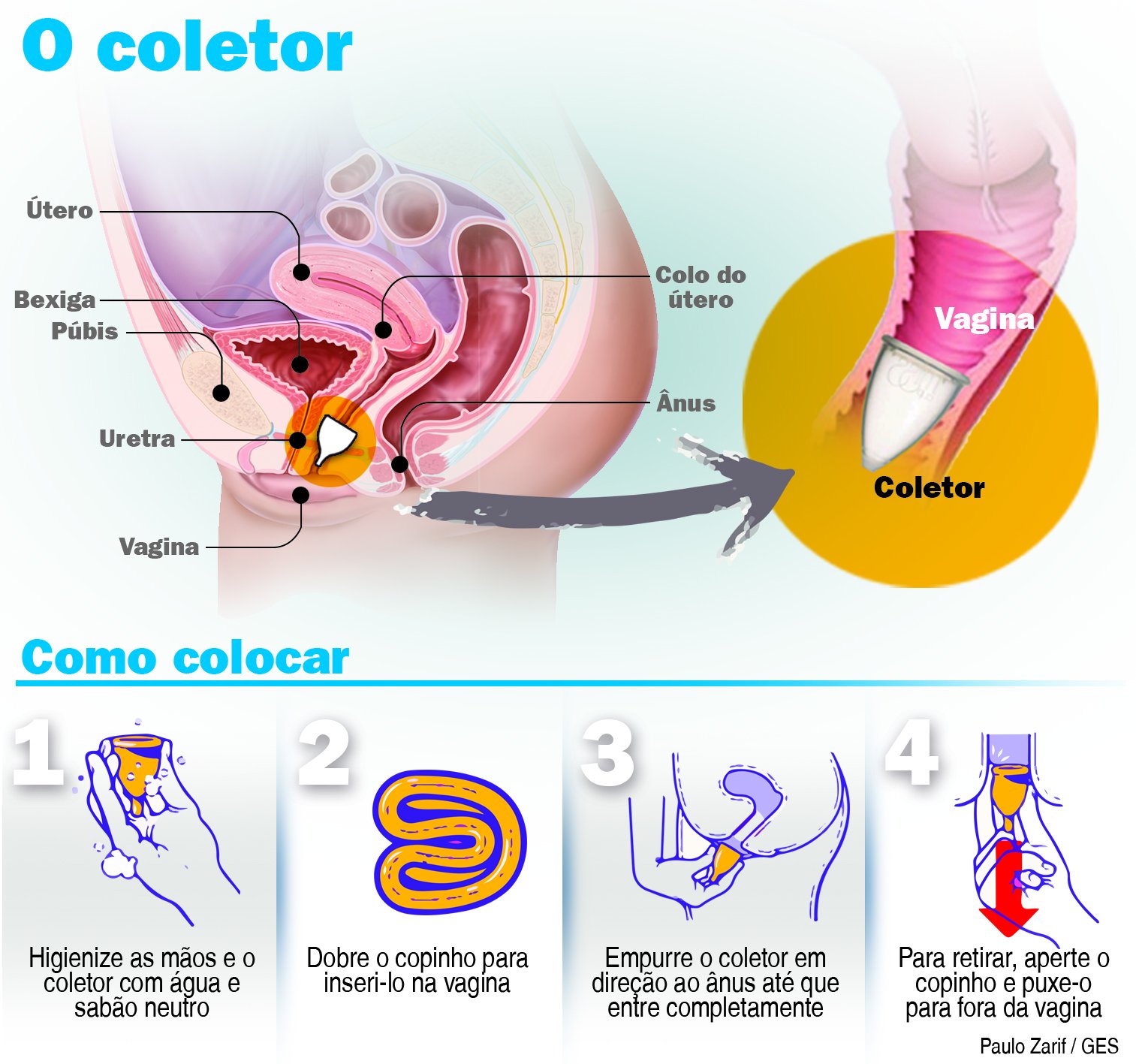 Coletor menstrual: o que muda com a regulamentação da Anvisa - Viver com  saúde - Jornal NH