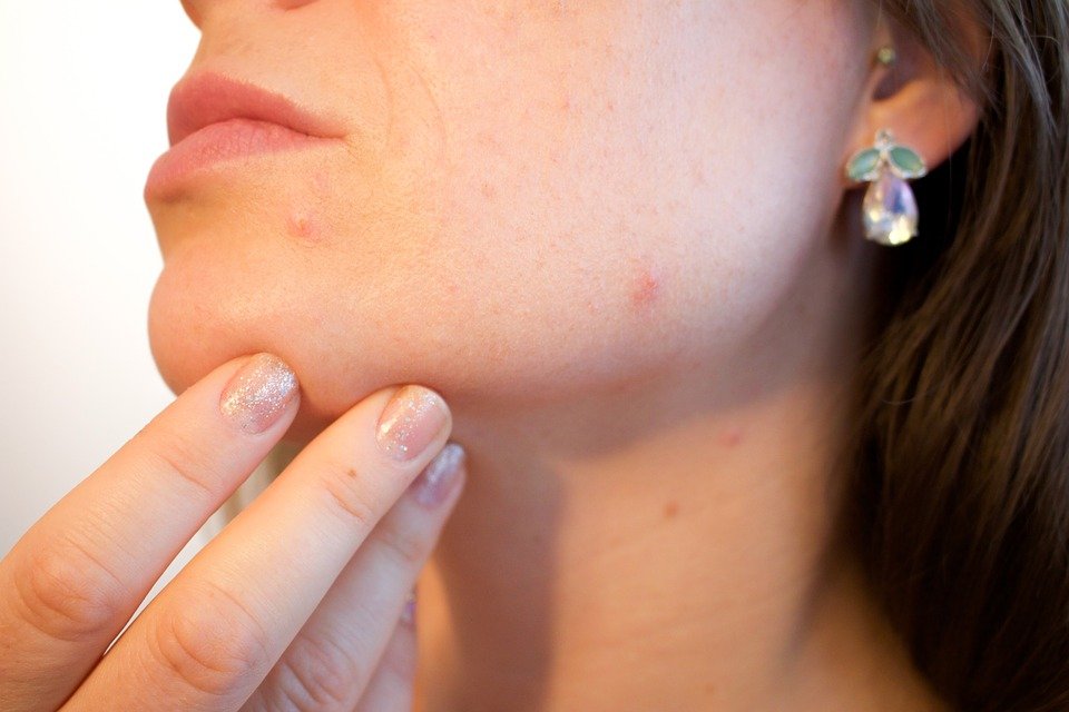 Câncer de pele: 95 postos de atendimento gratuitos com dermatologistas estão espalhados pelo Brasil neste sábado (13)