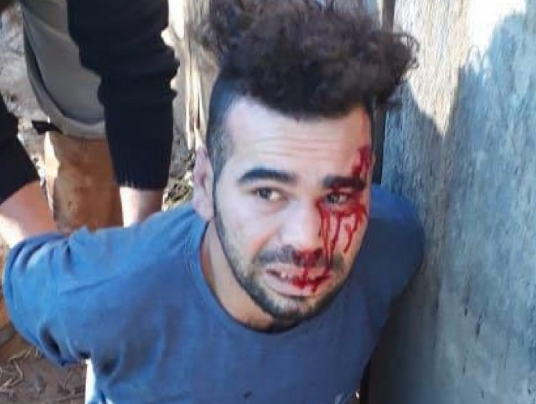 Surge pista sobre jovem torturado por milícia em Sapiranga - Jornal VS