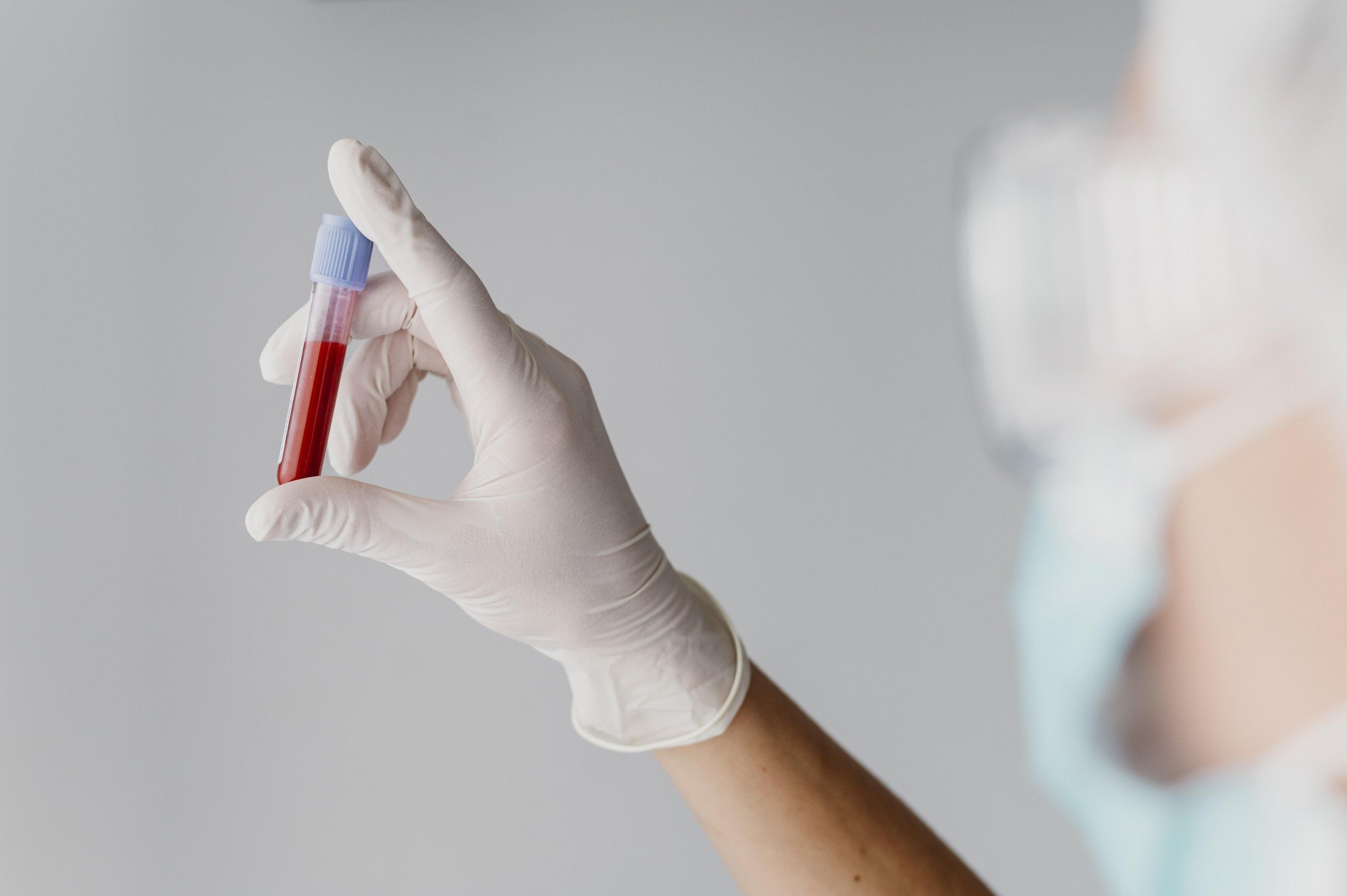 Farmácia pode fazer exame de sangue? Veja a lista de testes clínicos autorizados pela Anvisa