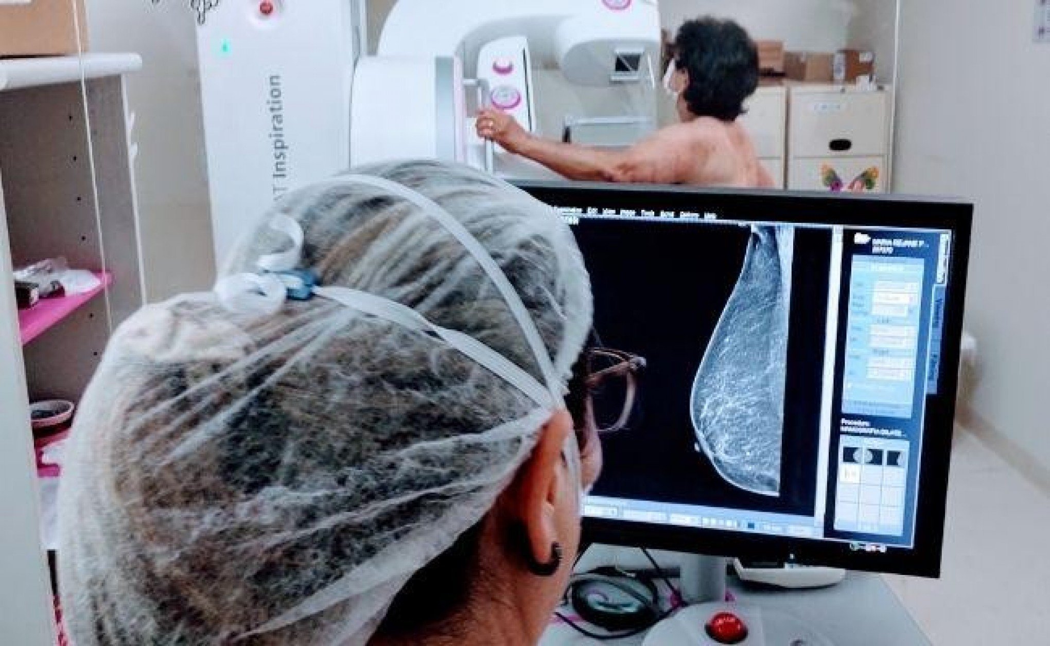 Região já adotava mamografias a partir dos 40 anos antes de nova diretriz nacional