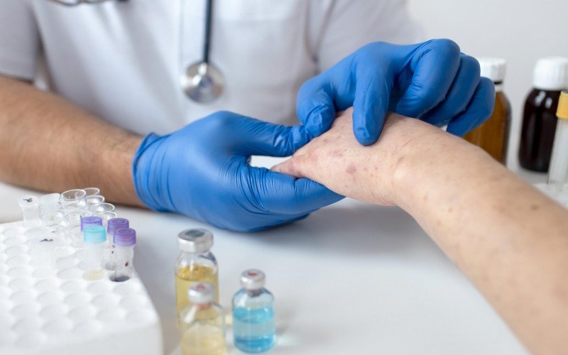 Primeiro lote da vacina contra varíola dos macacos chega ao RS nesta terça-feira