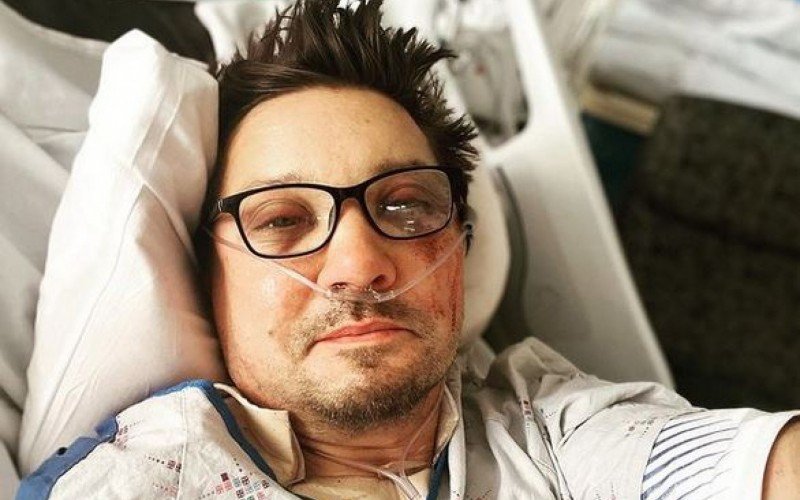 Jeremy Renner publicou foto após cirurgia | abc+