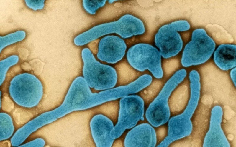 Tanzânia confirma surto do vírus de Marburg, um dos mais letais do mundo