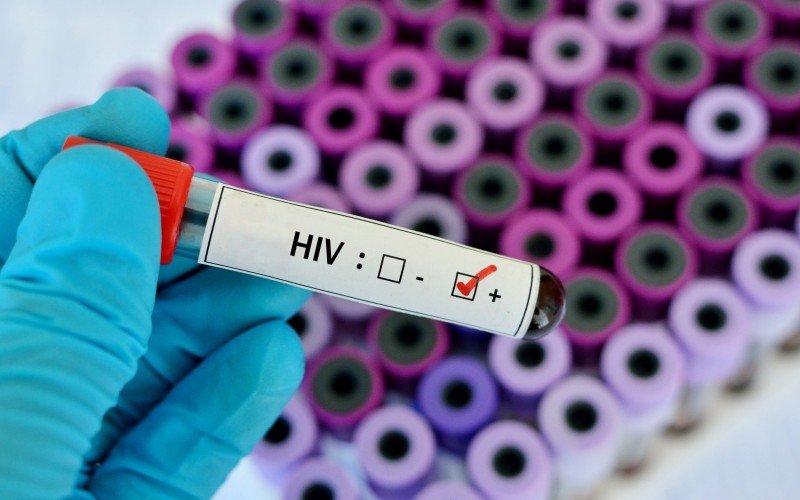 Infecção por HIV na mira da pesquisa | abc+