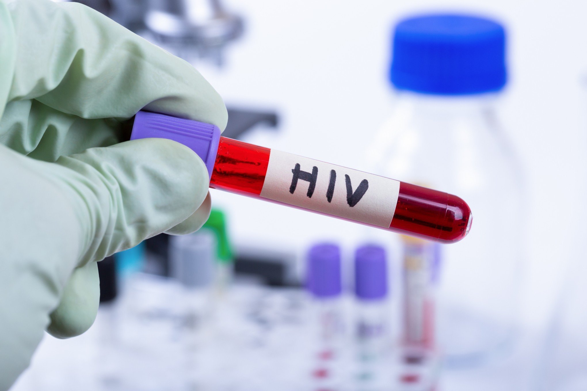 Nova variante do HIV é detectada no Rio Grande do Sul; veja o que se sabe sobre o vírus