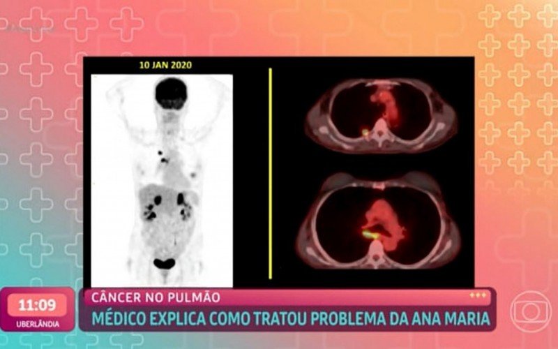 Médico de Ana Maria Braga compartilha imagens inéditas sobre o tratamento da apresentadora | Jornal NH