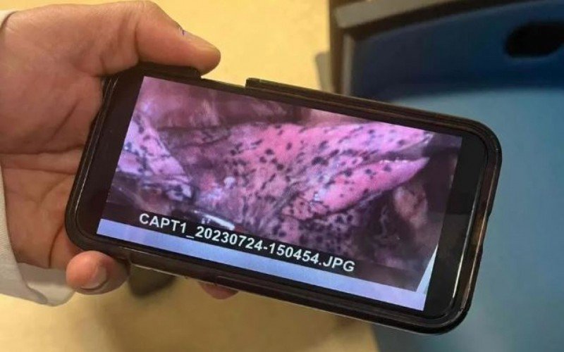 Pulmão de lutador de MMA que fuma vape desde os 15 anos, está cheio de manchas pretas | Jornal NH