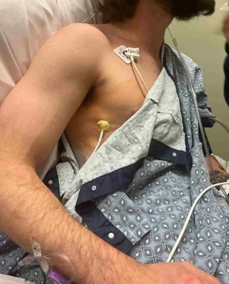 Lutador de MMA diz que só respira com o auxílio de tubos | Jornal NH