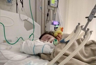 Imagem de quando Calebe teve uma parada cardÃ­aca com 7 meses e foi entubado. 