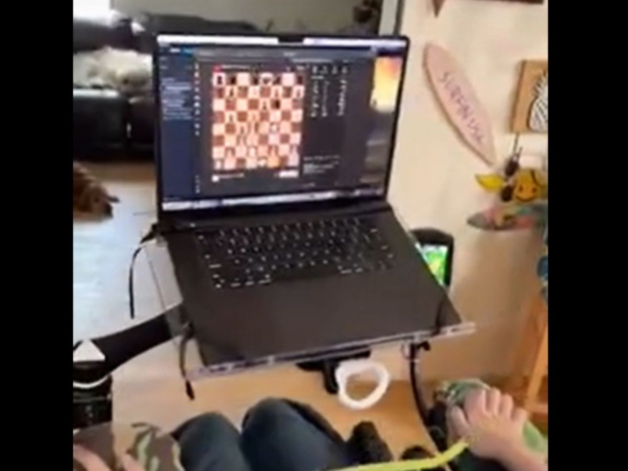 VÍDEO: Primeiro homem a receber implante cerebral de Musk joga xadrez com a mente