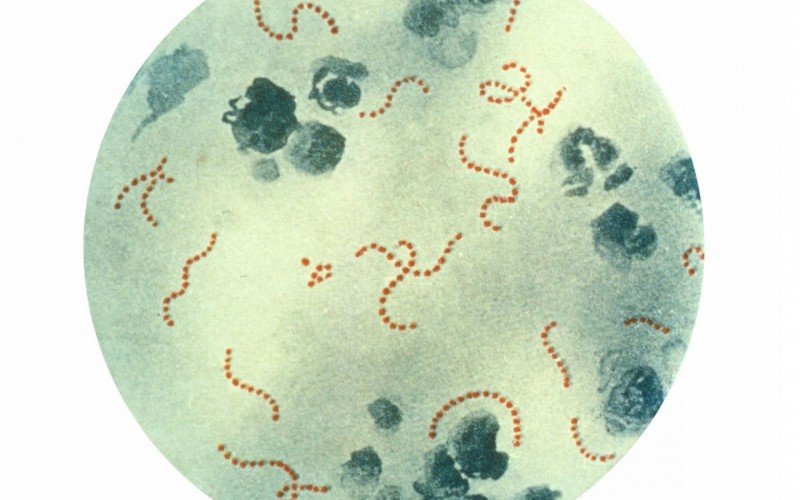 Doença é causada pela bactéria streptococcus pyogenes | abc+