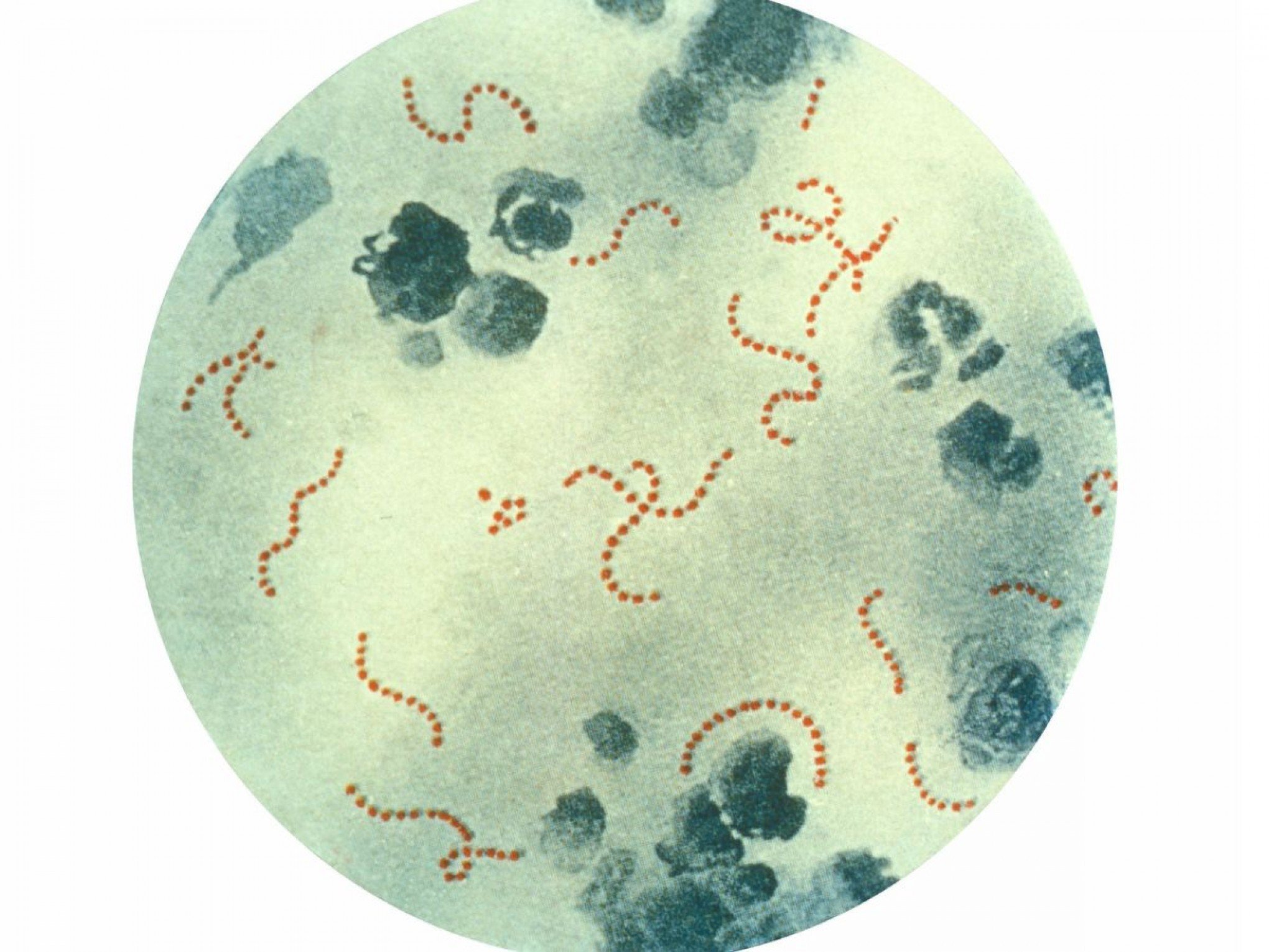 Bactéria apelidada de "comedora de ânus"? Doença perigosa está se espalhando pelo Japão