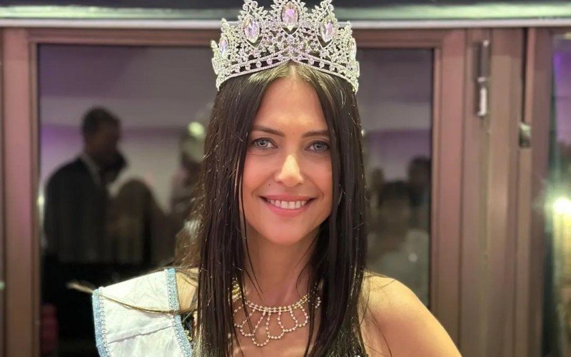 Modelo argentina de 60 anos pode concorrer ao Miss Universo | abc+