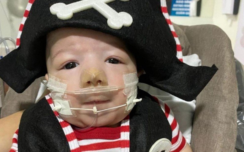 Arthur, filho de Zé Vaqueiro e Ingra Soares, faleceu aos 11 meses; ele possuía Síndrome de Patau | abc+