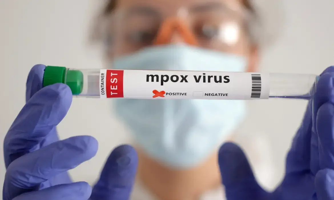 MPOX: Nova recombinação de cepas é identificada pela OMS