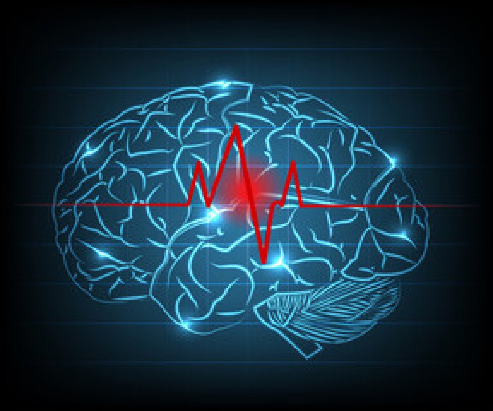 Sabia que uma a cada quatro pessoas terá AVC ao longo da vida? Veja os sinais de alerta, os fatores de risco e como prevenir