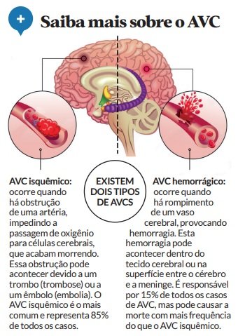 Saiba mais sobre o AVC