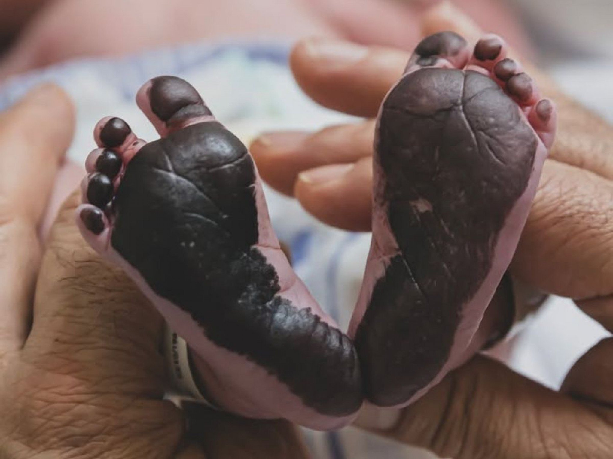 Nasce antes do tempo filha de Zezé Di Camargo e Graciele Lacerda