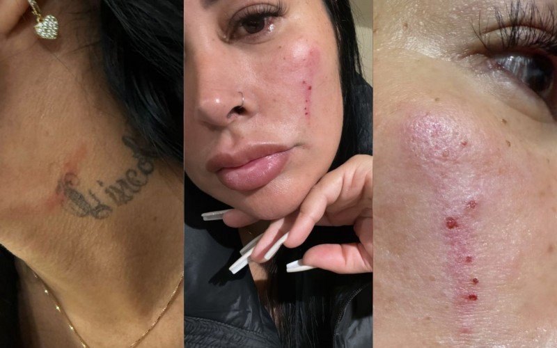 Esposa de ex-Grêmio diz ter sofrido agressão e xenofobia na Europa | abc+