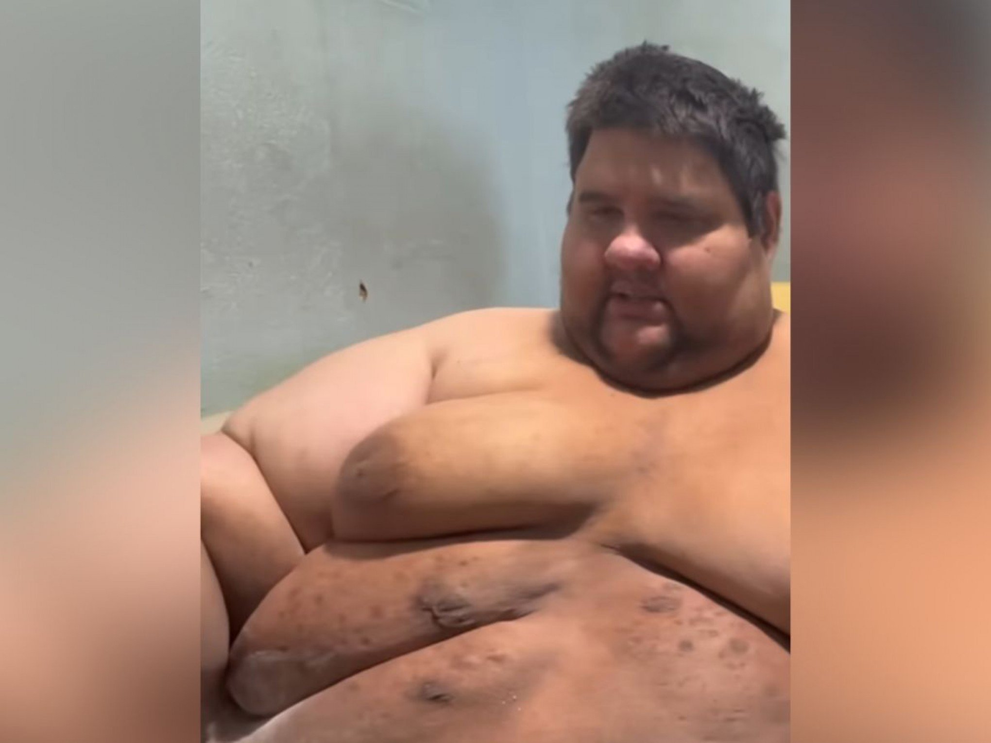 Quem é o influenciador que morreu aos 37 anos após chegar a pesar 380 kg