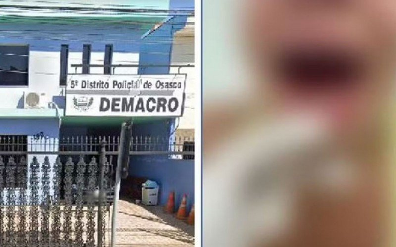 Imagem da língua arrancada circula pelas redes sociais | abc+