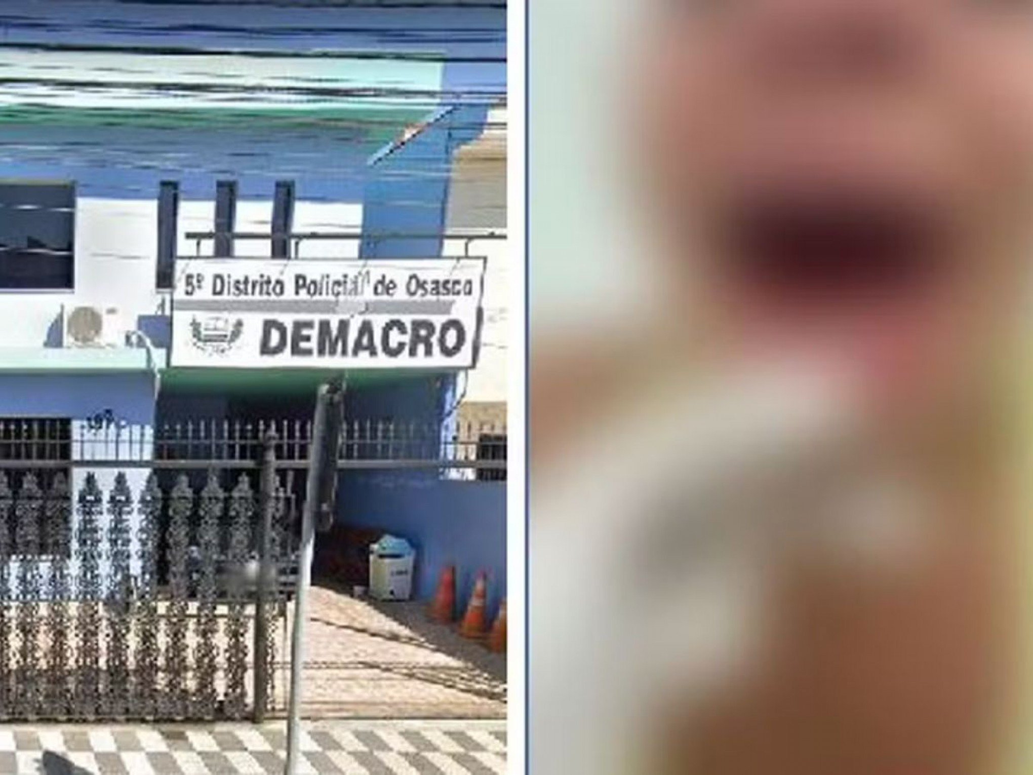 "Ele mordeu minha língua e a puxou": Mulher é alvo de crime brutal cometido pelo companheiro; saiba como Polícia descobriu
