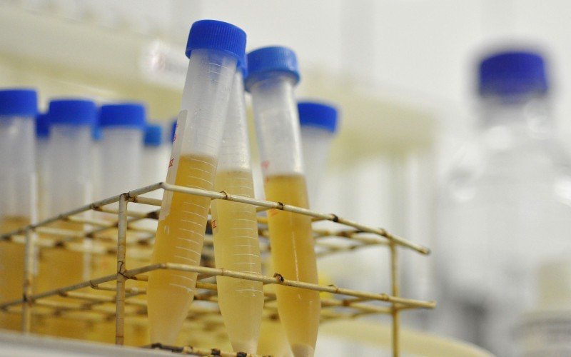 Lagoa da Conceição, em Florianópolis-SC, tem grande quantidade de cocaína nas águas  | abc+