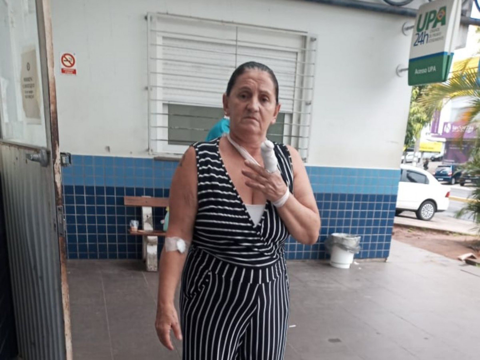Mulher quase perde dedo após ser mal atendida na UPA Caçapava em Canoas