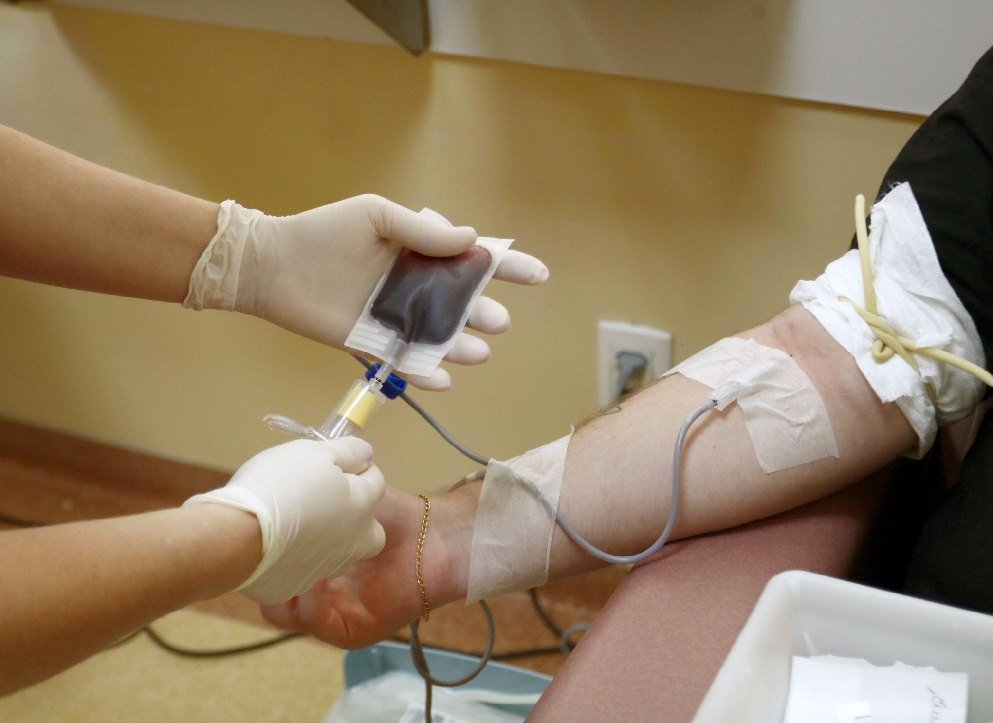 Hospital Universitário promove ação de doação de sangue neste sábado em Canoas