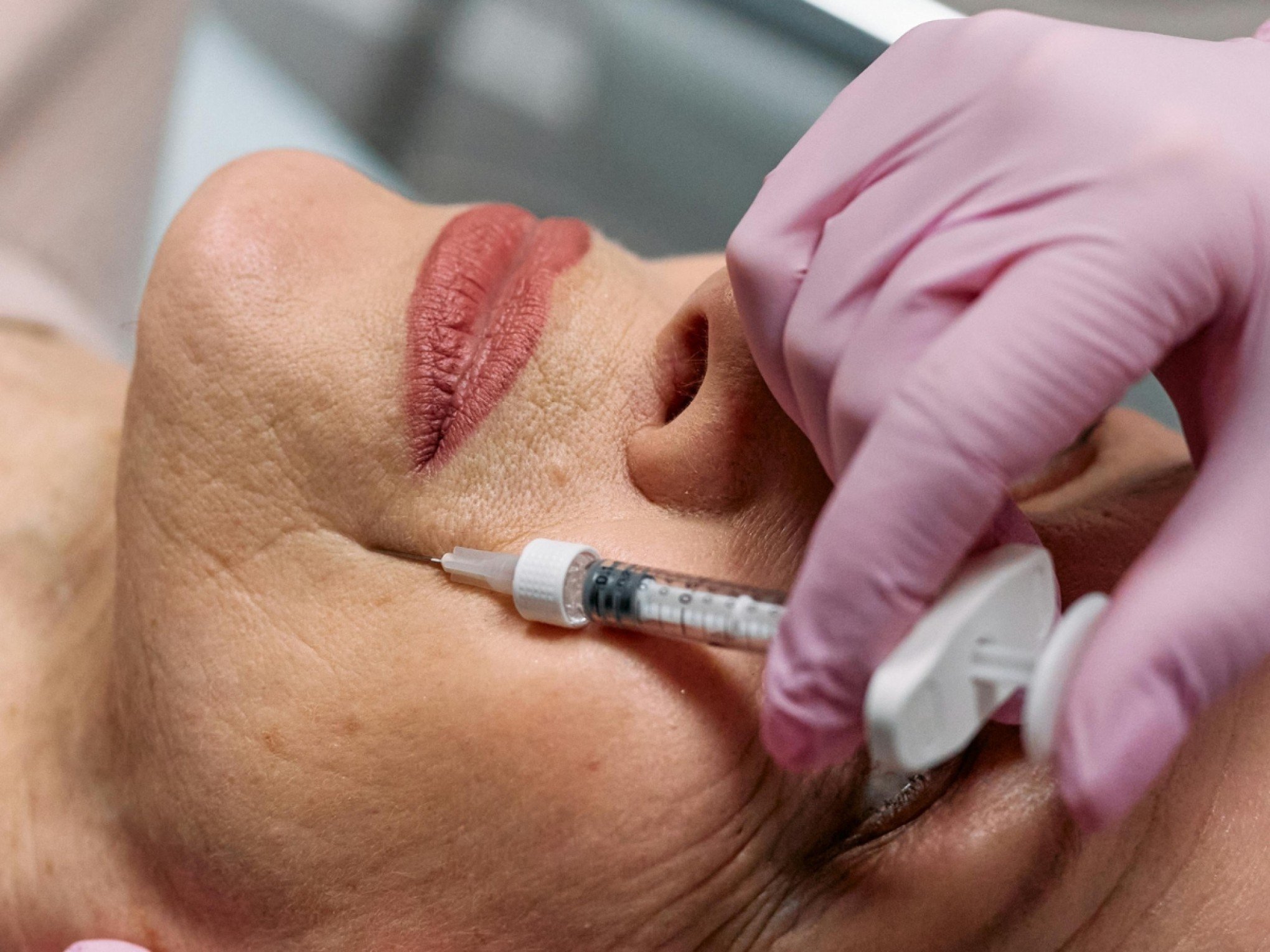 Casos de botulismo após aplicação de botox levam Anvisa a solicitar mudanças na bula de produtos