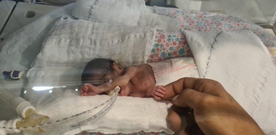 VÍDEO: Bebê que nasceu com 465 gramas no Hospital de Clínicas de Porto Alegre recebe alta