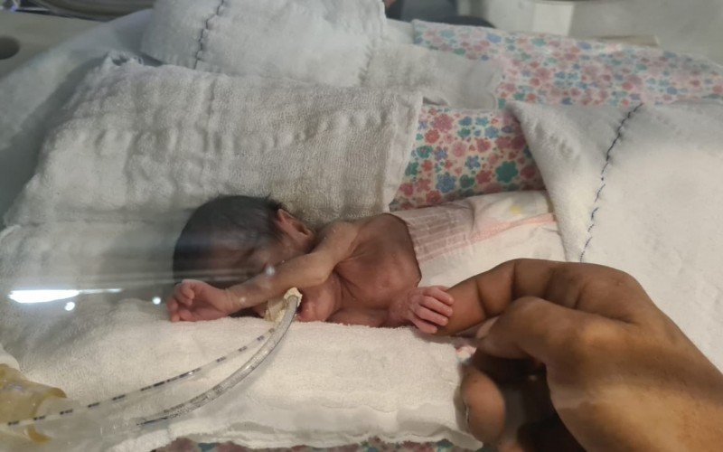 Prematura que nasceu com o menor peso na história do Hospital de Clínicas de Porto Alegre recebe alta