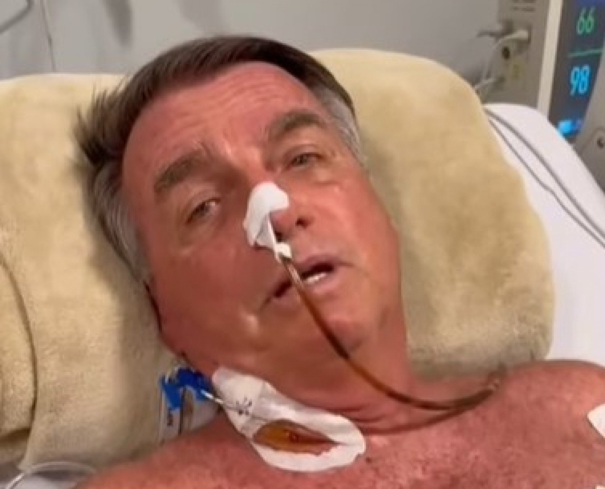 Confira o primeiro boletim médico de Jair Bolsonaro após cirurgia