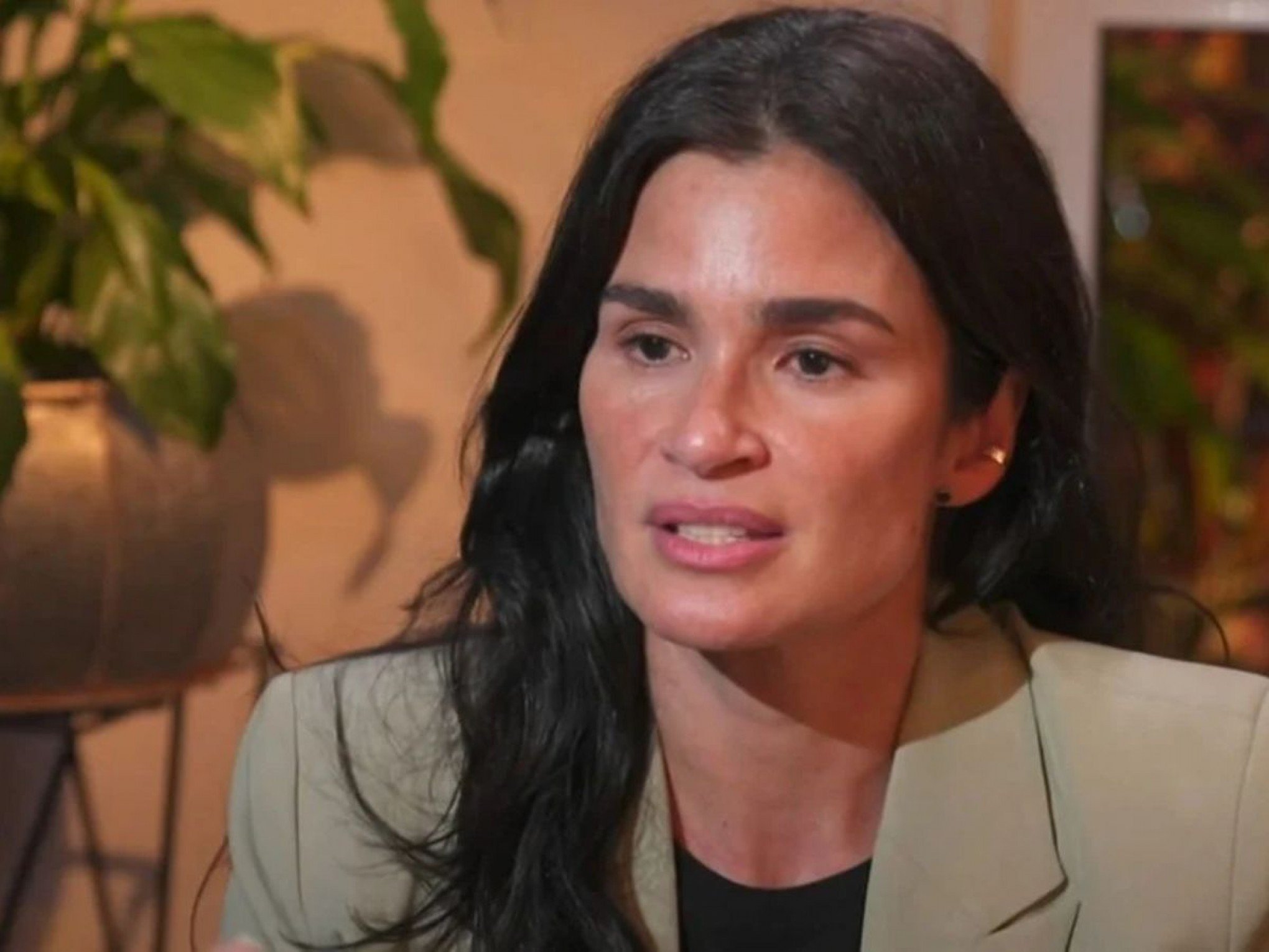 "Fiquei 17 dias sem dormir": Modelo Carol Ribeiro detalha diagnóstico de esclerose múltipla e faz alerta sobre sintomas