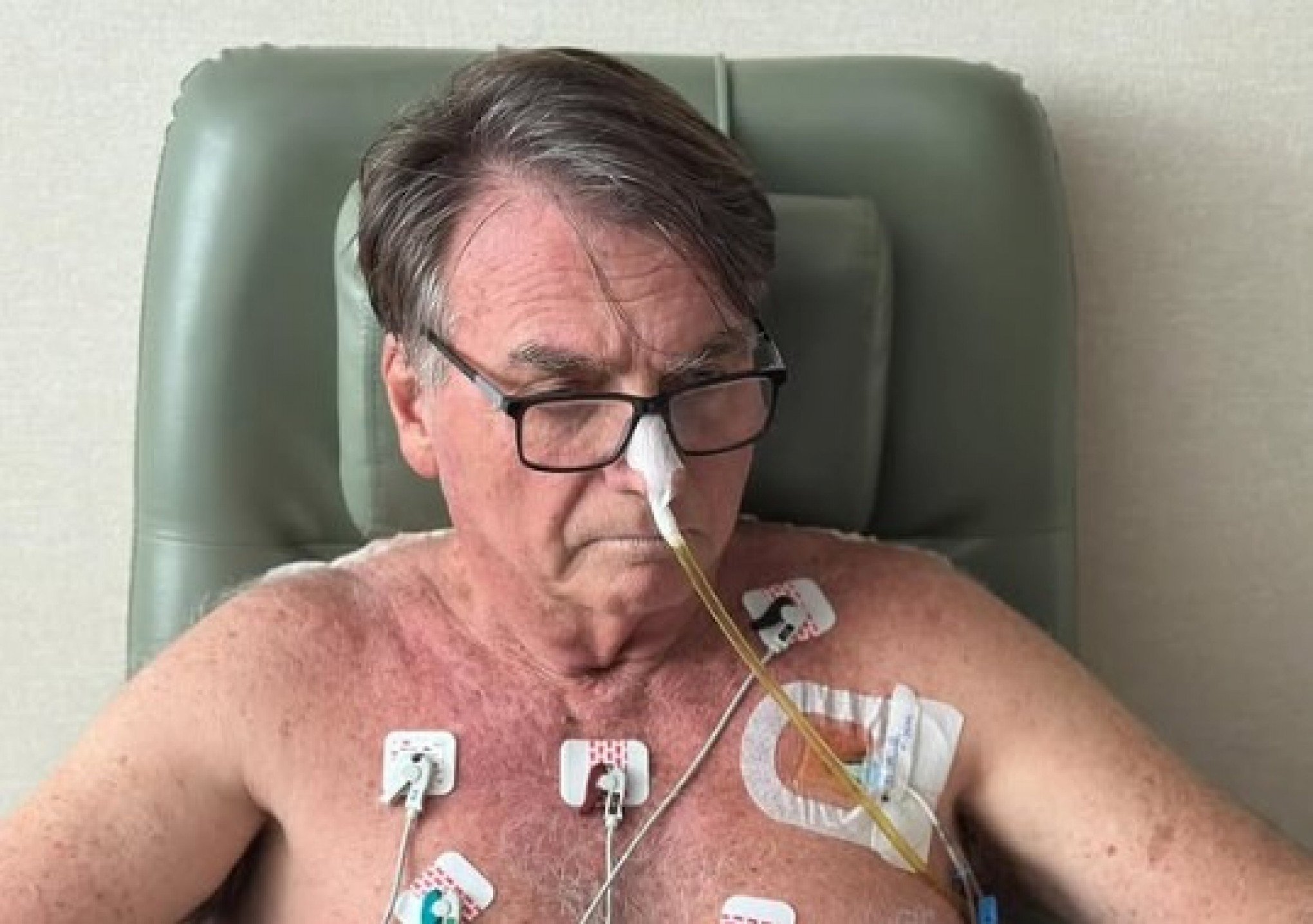Veja o que diz novo boletim médico sobre saúde de Bolsonaro