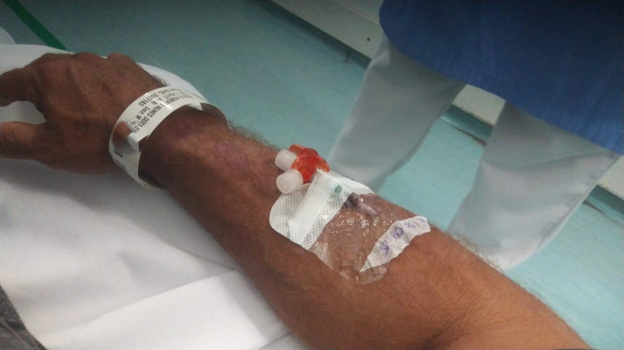 "Ele pode perder a mão": Trabalhador obrigado a decepar dedo pelo chefe volta a ser internado