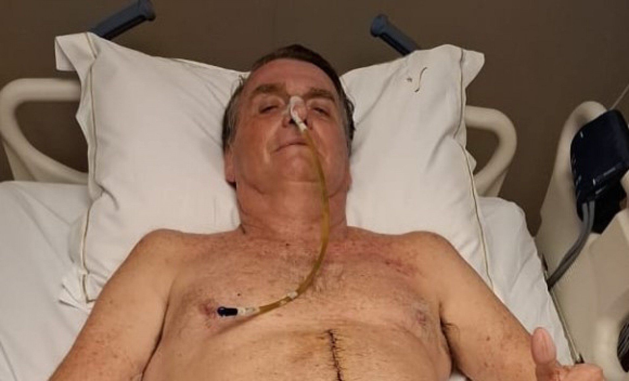 Após live na UTI, STF intima Bolsonaro em hospital de Brasília
