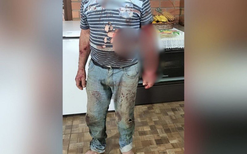 Homem foi supostamente atacado por puma em Maquiné | abc+