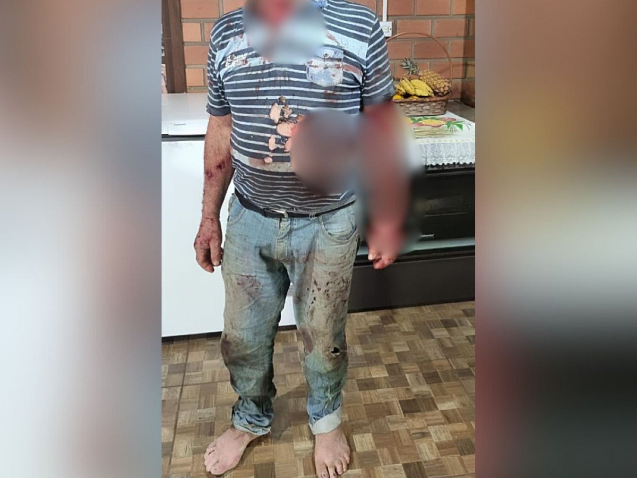 Ataque de puma? Homem é ferido por animal silvestre no litoral norte