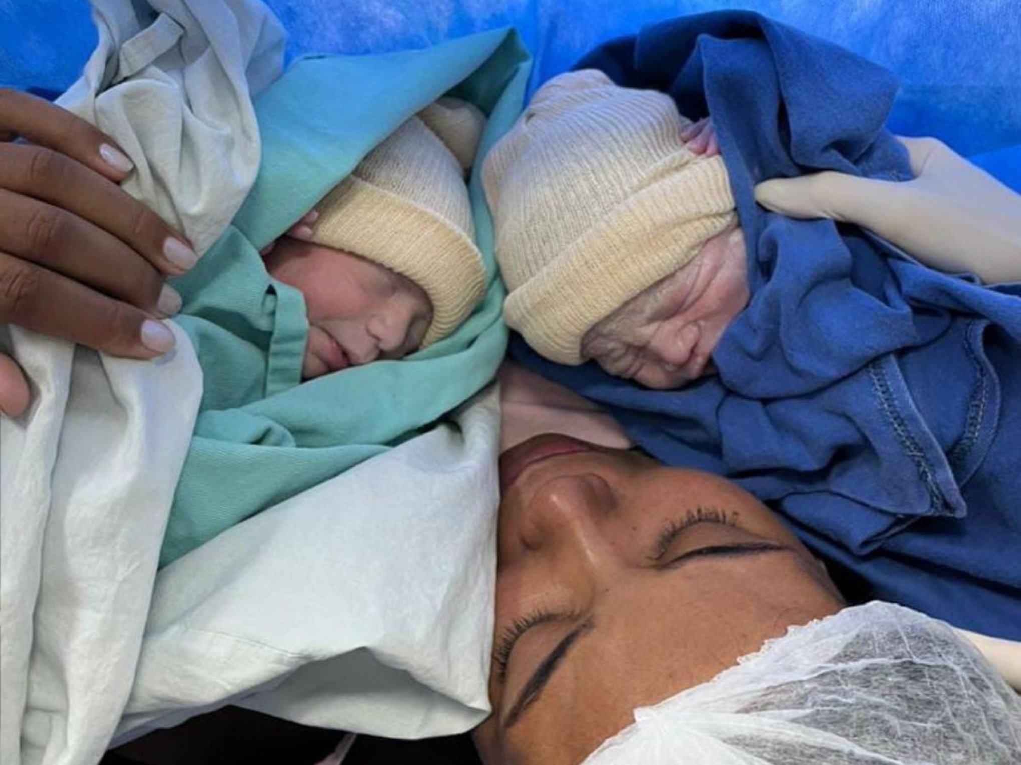 VÍDEO: Hospital de Novo Hamburgo registra mais um nascimento de bebê empelicado