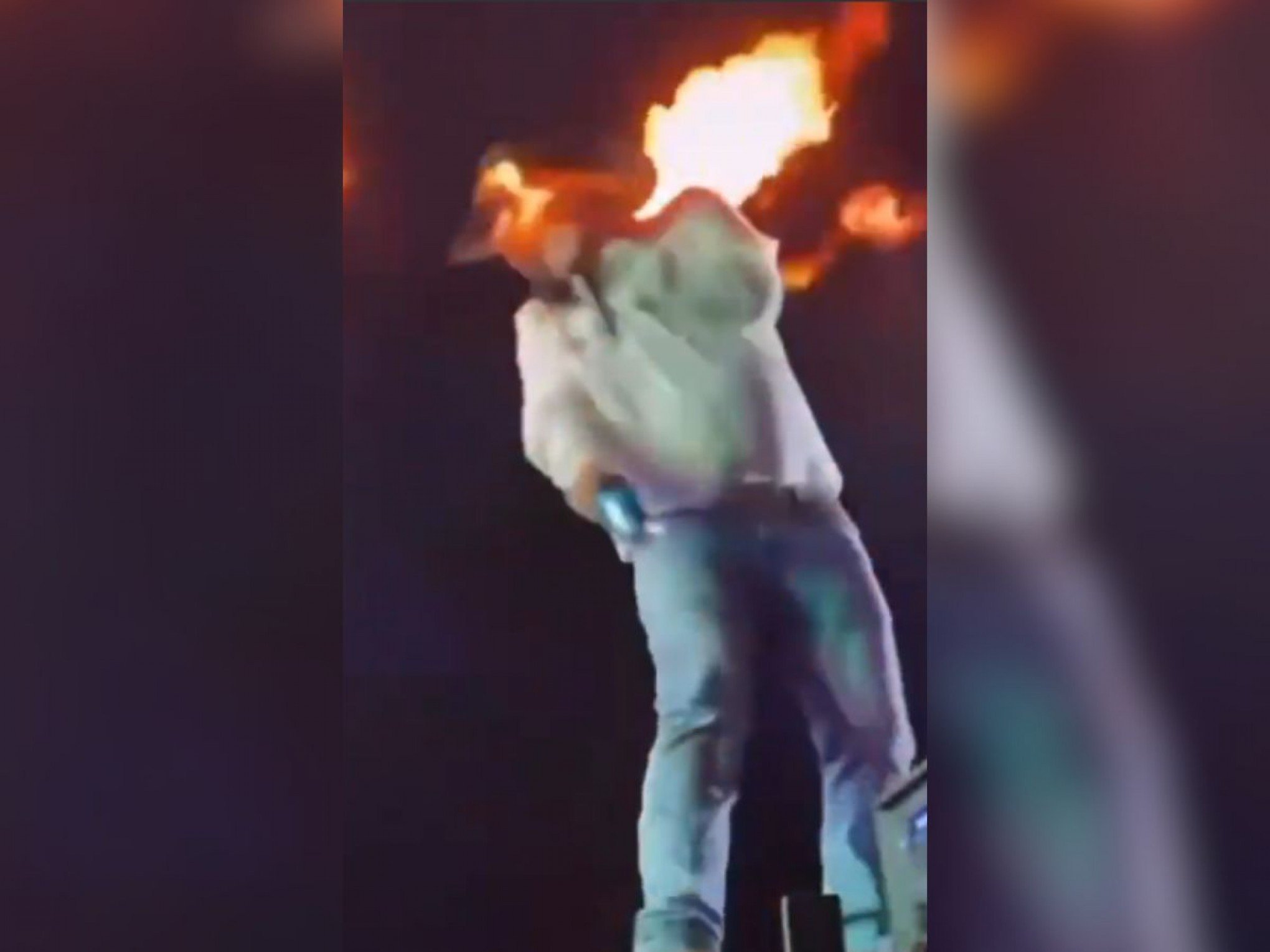Cantor sertanejo atingido por chamas mostra cicatrizes: "Tá todo mundo preocupado para ver como tá minha cara"