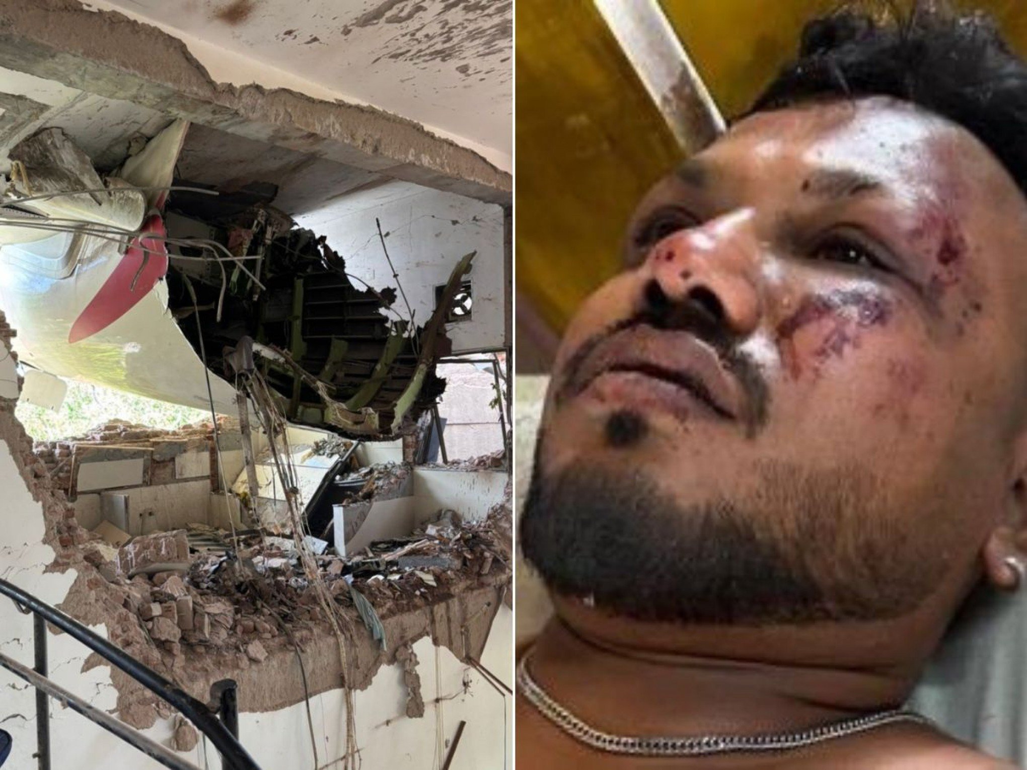 "Quando me levantei, havia corpos ao meu redor": Sobrevivente conta que avião começou a cair e se partiu ao meio logo após decolagem na Índia