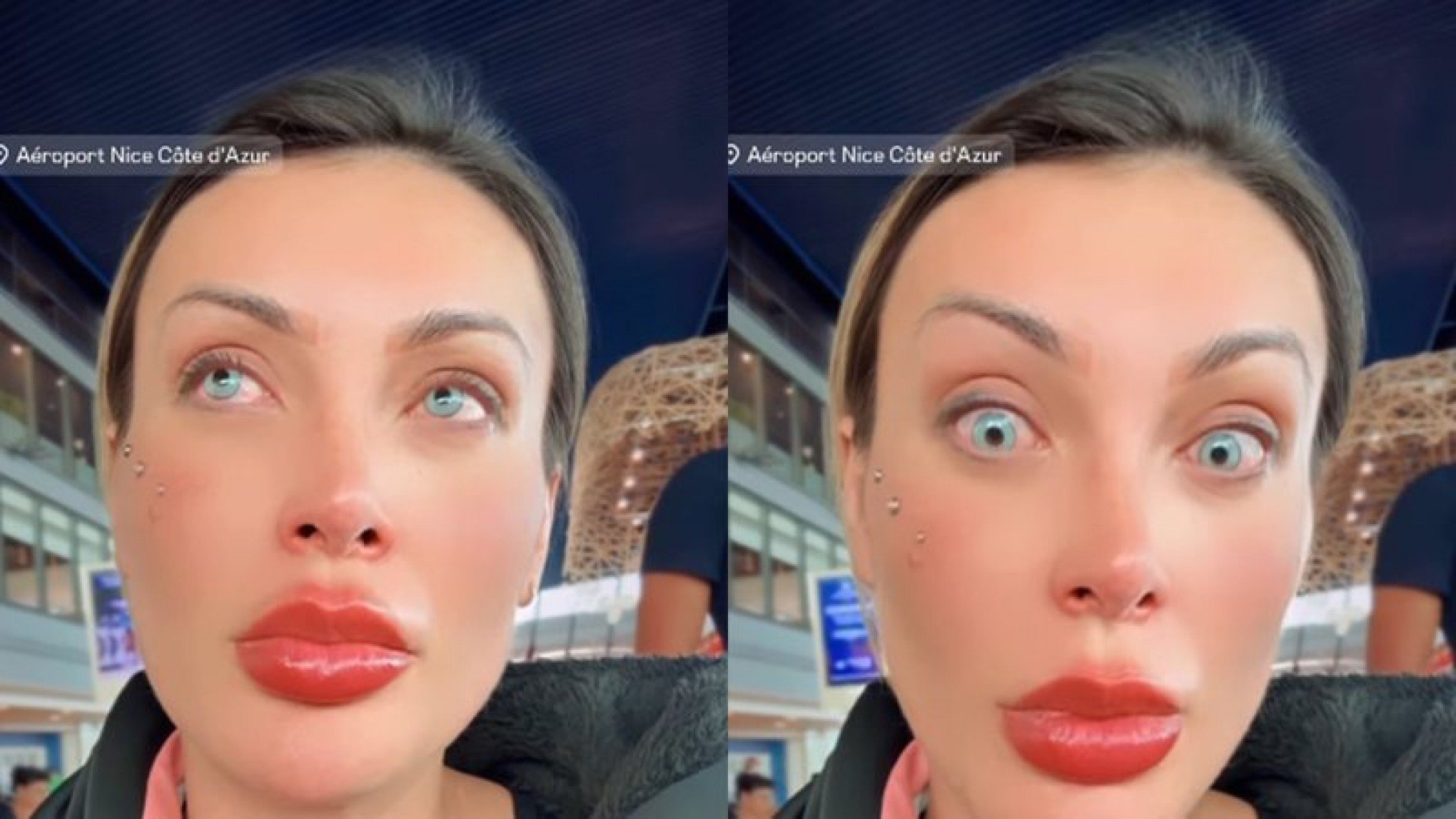 Andressa Urach faz mudança drástica após passar por procedimento proibido no Brasil e se arrepende: "A dor não tem igual"