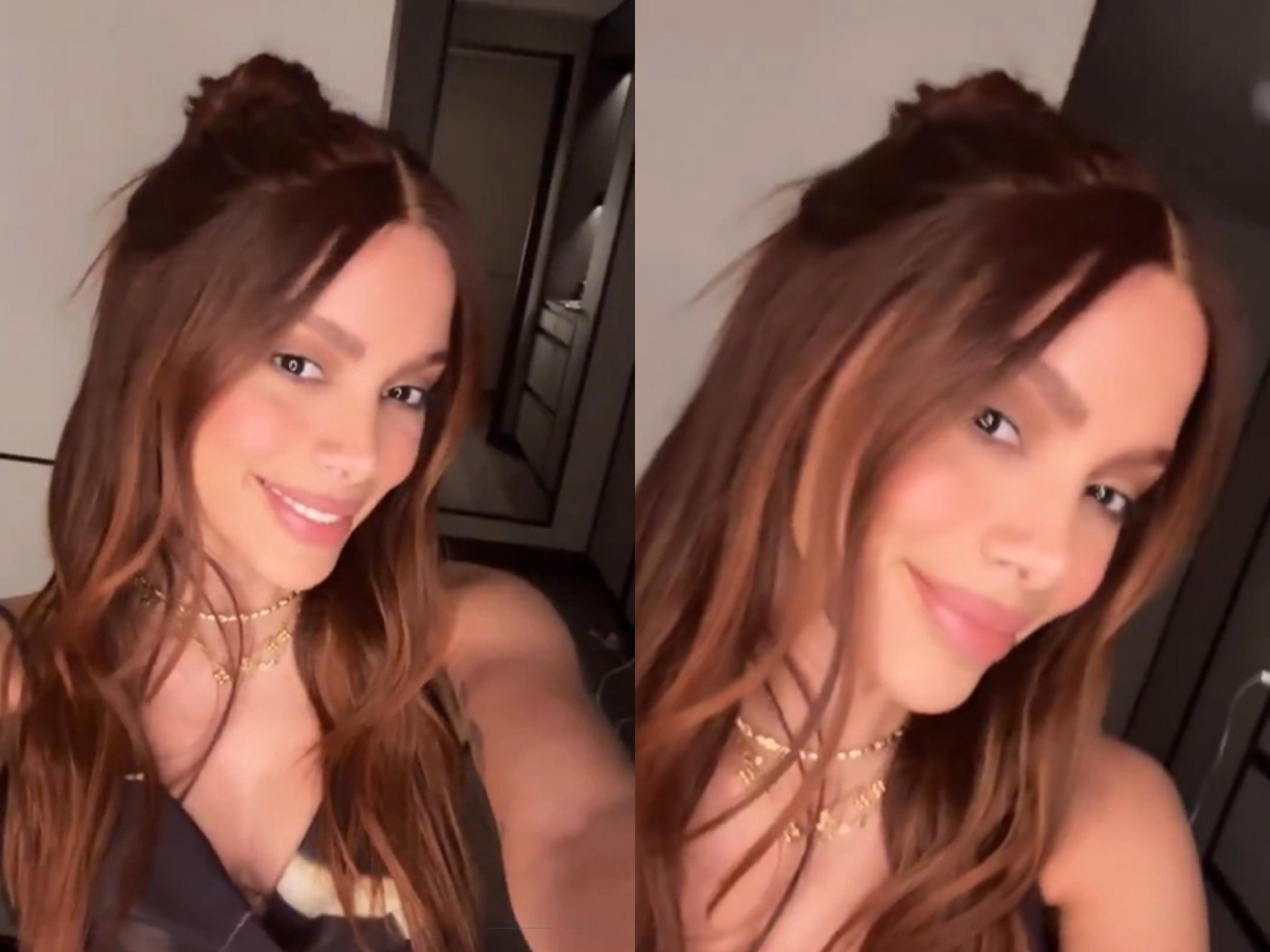 Anitta aparece com novo rosto e fãs ficam chocados: "Parecendo a Juliette"