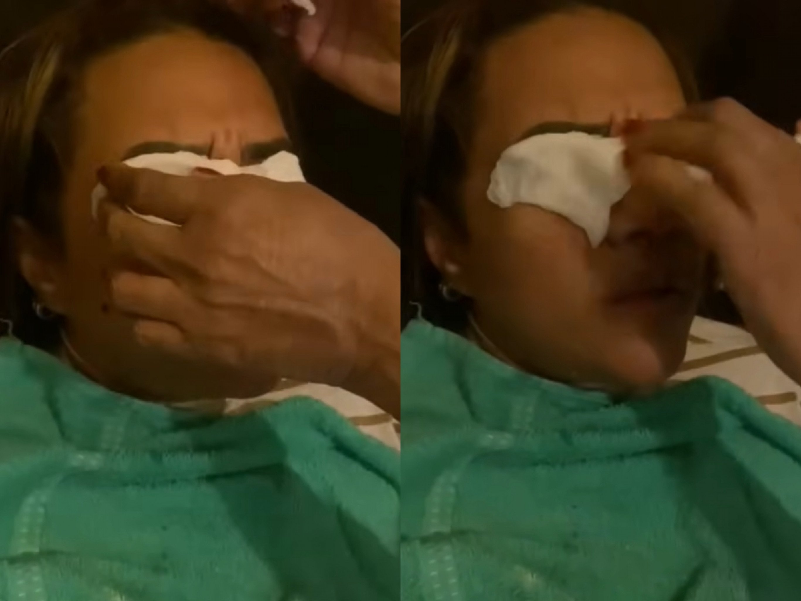 "Parece uma gilete nos meus olhos": Mulher diz ter córneas queimadas após usar produto da Wepink