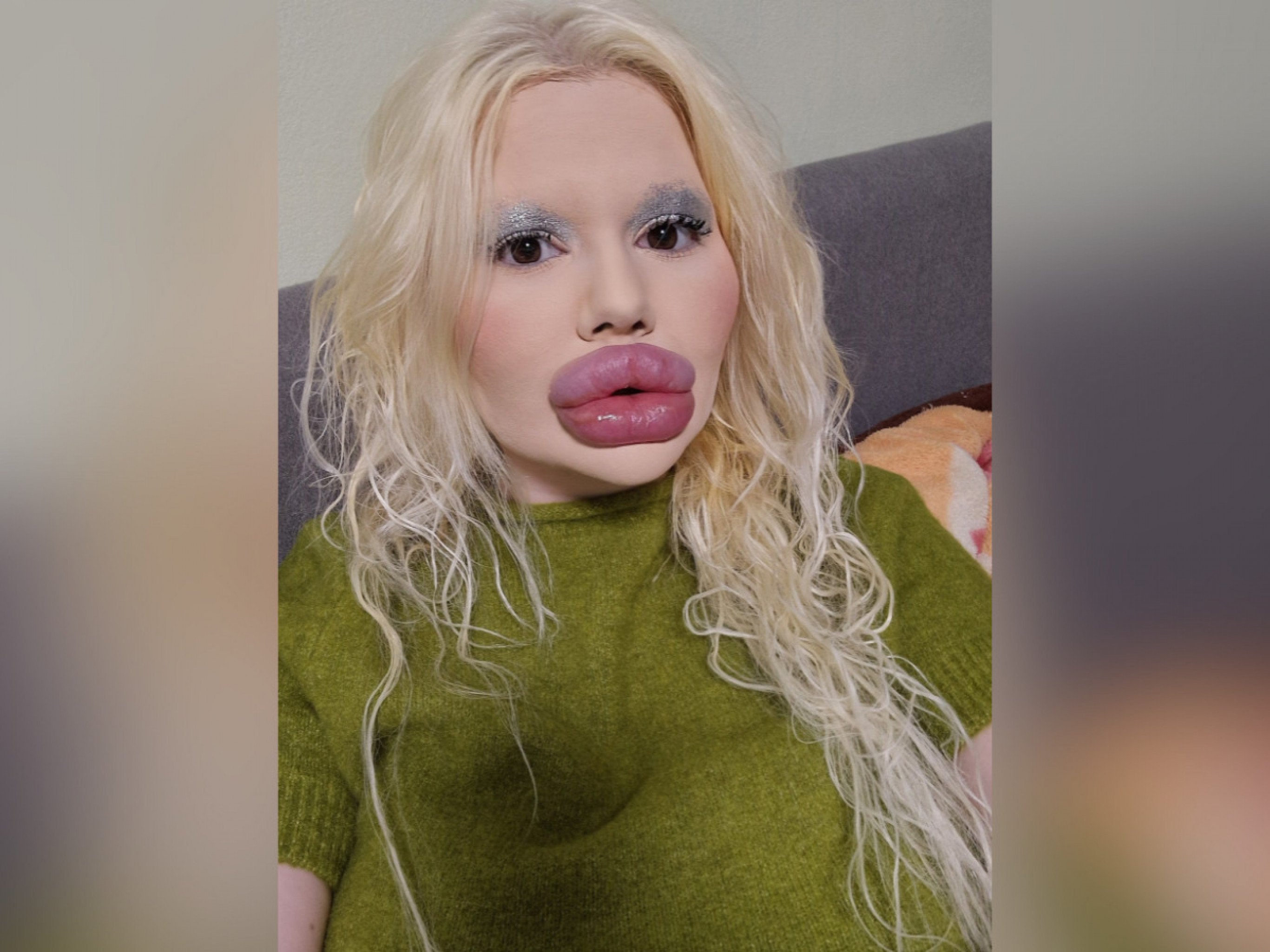 Mulher com "maiores lábios do mundo" diz que dentistas não querem atendê-la