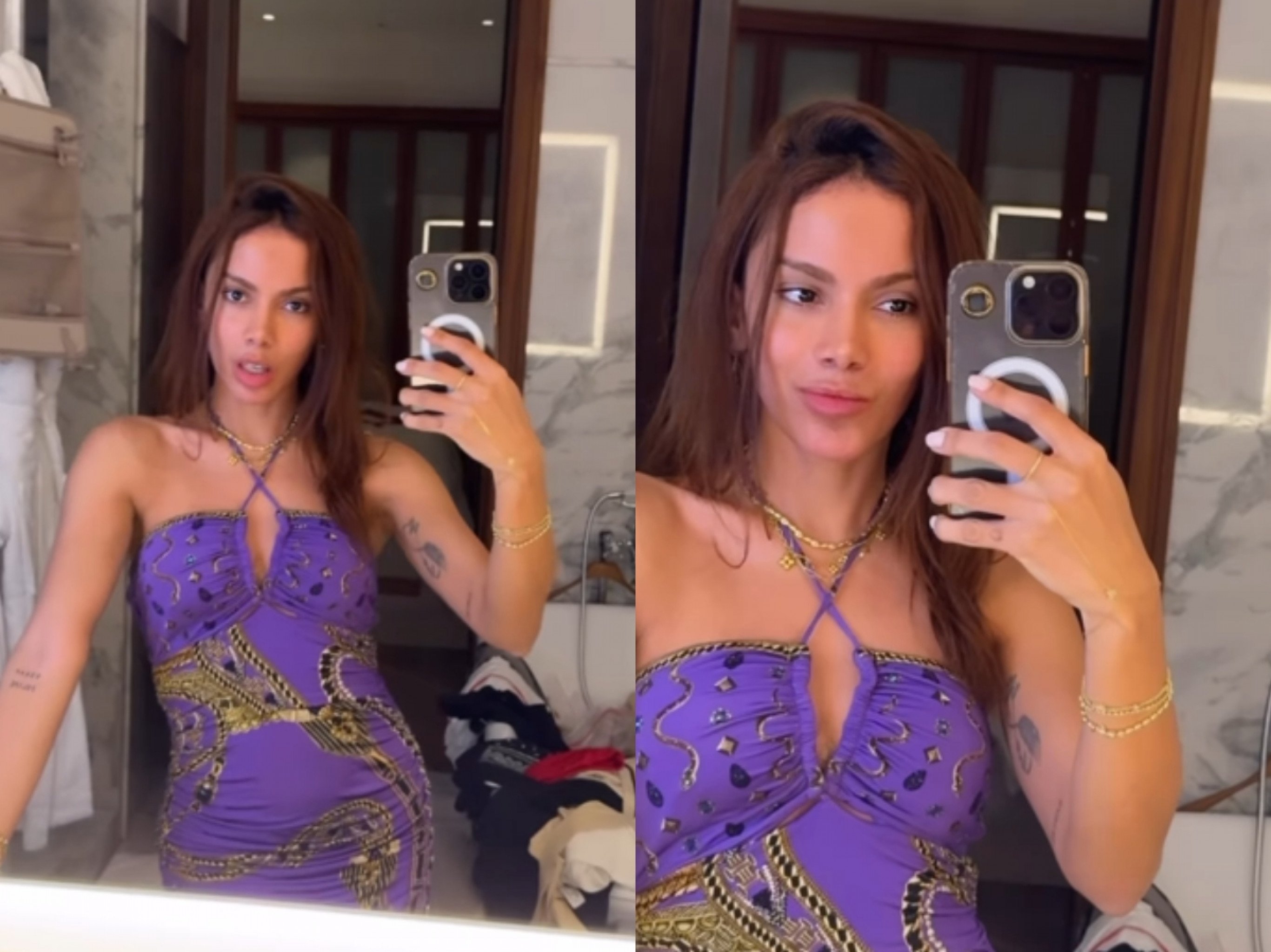 Anitta fala sobre "novo rosto" pela primeira vez: "Se amanhã quiser virar Sméagol ou Fofão, eu viro"