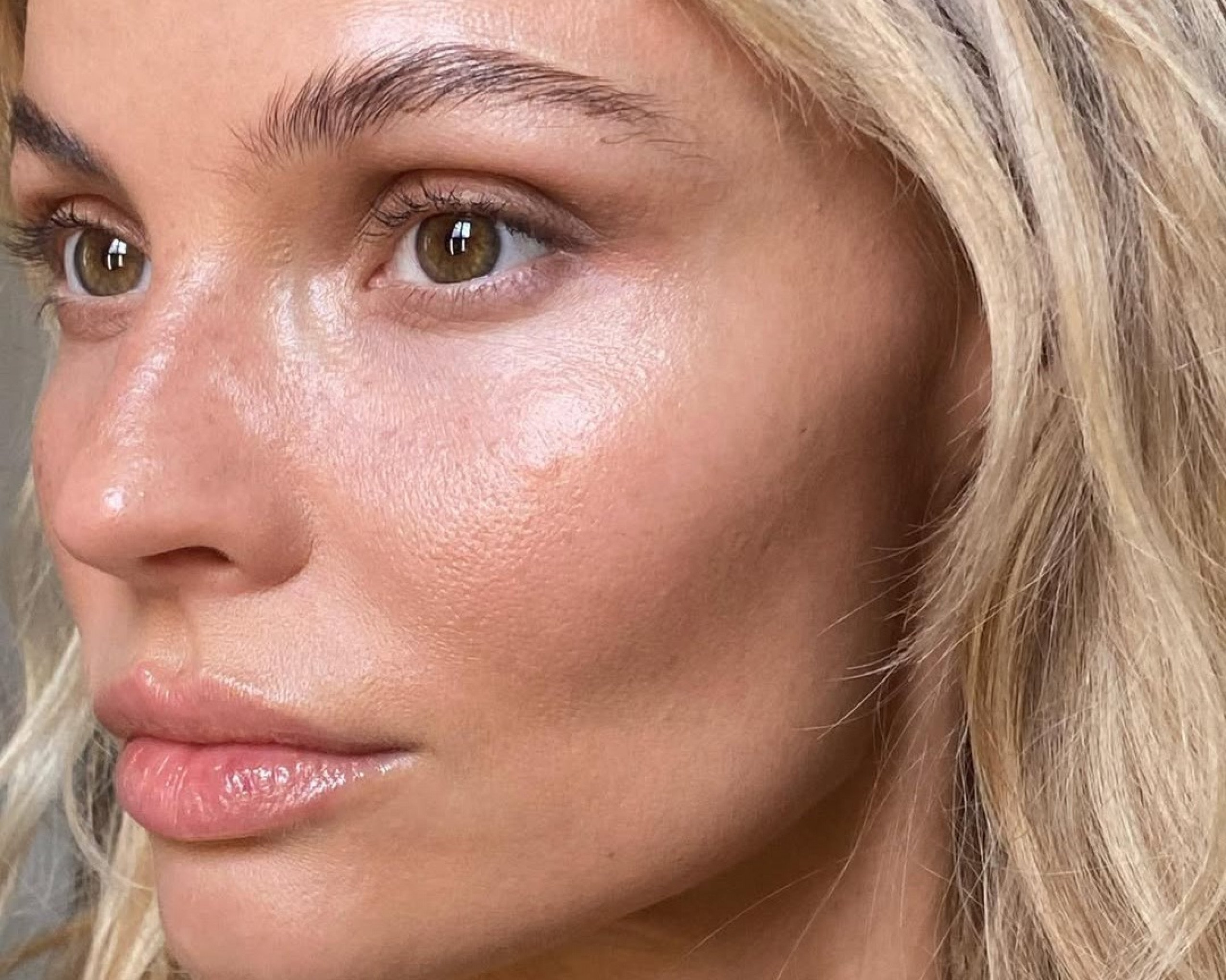 Adeus, manchas! 3 ativos que funcionam no skincare